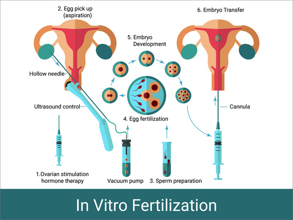 fertility treatment Kochi